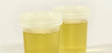 L'infection urinaire, un problème fréquent chez les femmes ménopausées
